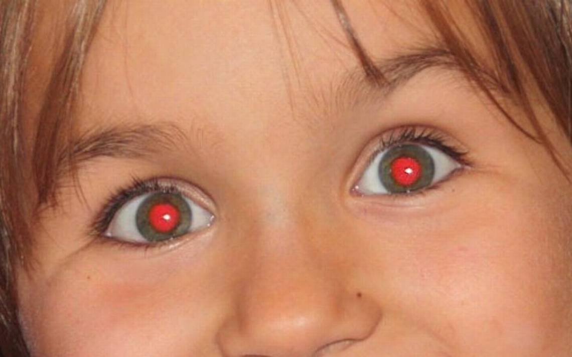 ¿ojos Rojos En Fotos Con Flash El Grave Problema Ocular Que Podrías Detectar A Tiempo El Solemk 8670